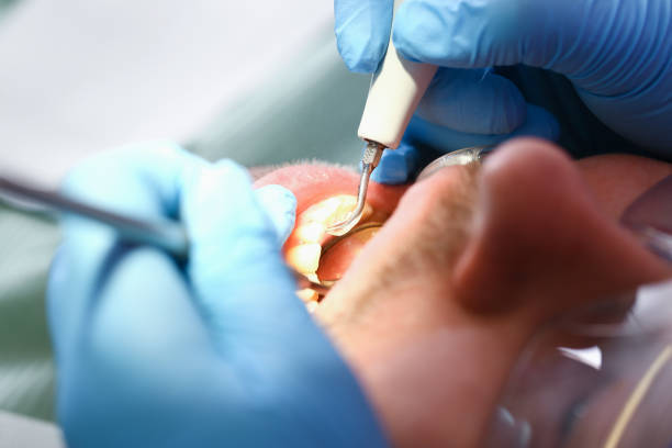 Best Emergency Orthodontic Repairs in Coalgate, OK