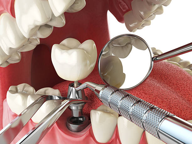 Best Emergency Treatment for Toothache in Coalgate, OK